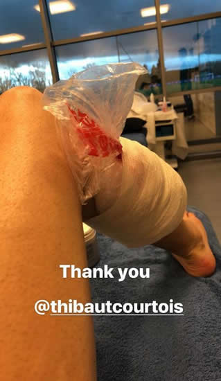 Chelsea star Cesc Fabregas sarcastically thanks Thibaut Courtois on Instagram as pair meet in treatment room after nasty clash in training
