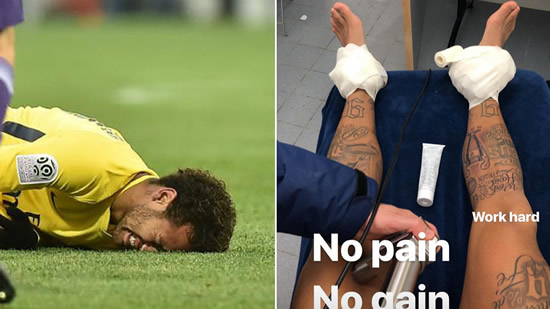 Neymar shares an image of his battered ankles
