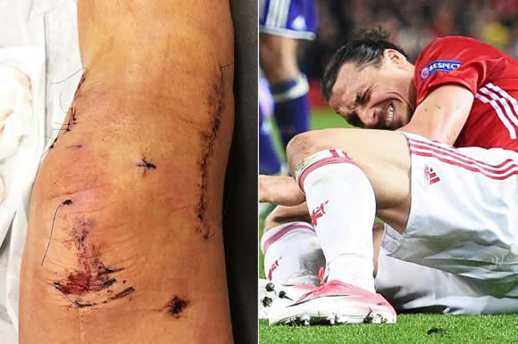 'THEY SAID IT WAS OVER' Zlatan Ibrahimovic reveals gruesome snap of career-threatening knee injury suffered at Manchester United