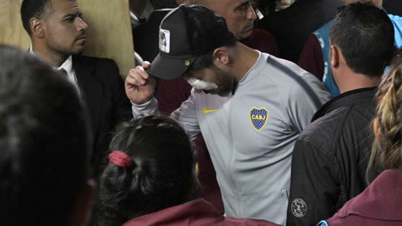 Copa Libertadores final postponed after attack on Boca Juniors bus