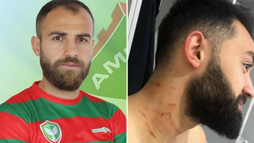 Mansur Calar Receives Lifetime Ban From Football After Attacking Rival Player