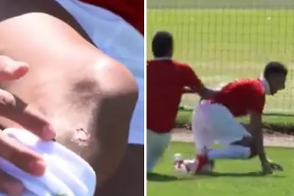 Man Utd star Jesse Lingard RINSED for 'injury' in hilarious clip – 'Out for the season'