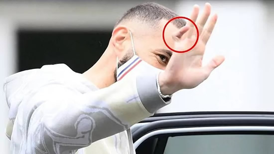 The story behind Benzema's bandaged hand