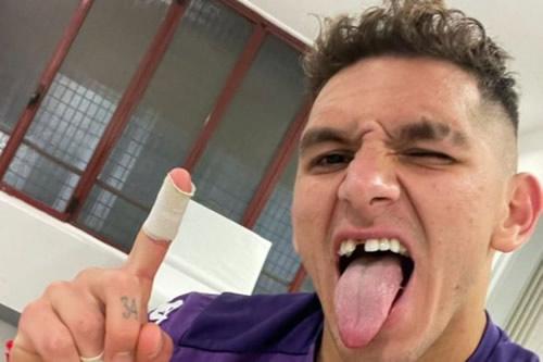 Arsenal star Lucas Torreira yanks out tooth during Serie A match and continues playing