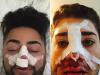 NOSE JOBS: Steven paid for Mark's flight to Poland – and hasn't been reimbursed