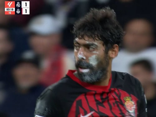 Daily Laugh - Yamal and his Double Champ