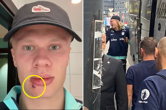 Erling Haaland needs three stitches as Man City star hit by Norway team bus – then jokes Arsenal ace punched him