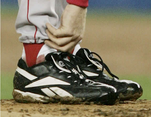 Neymar gets hit in ankle, winds up with Curt Schilling-esque bloody sock