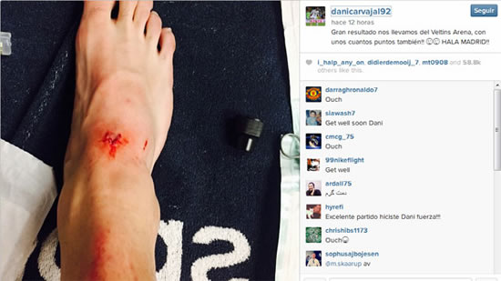 Whose are these war wounds?