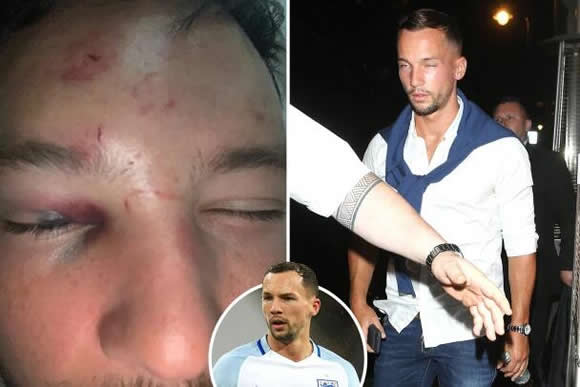 England ace Danny Drinkwater battered by six thugs outside nightclub after trying to bed another footballer's lover