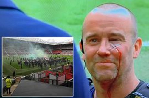 Police officer left with slashed face from Man Utd protests and required urgent stitches