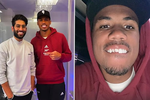 Arsenal's Gabriel Magalhaes shows off brand new smile after having teeth punched out