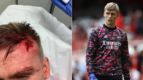 Arsenal Loanee Goalkeeper Runar Alex Runarsson Taken To Hospital After Nasty Head Clash